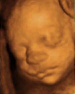 Il feto sente i sapori