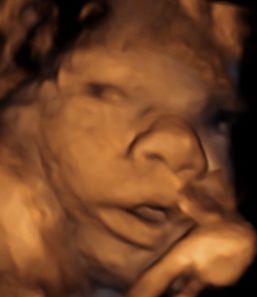 Il feto apre gli occhi?
