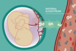 Prenatalsafe: addio all’amniocentesi?