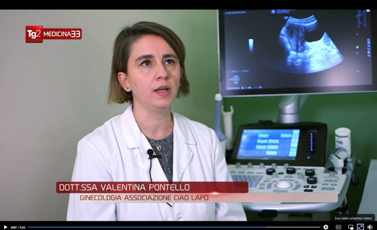 dr.ssa Valentina Pontello ginecologa
