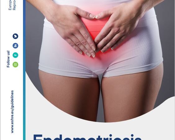 Endometriosi linee guida ESHRE in italiano